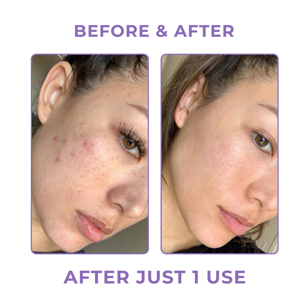 Bio-Collagen Real Deep Mask