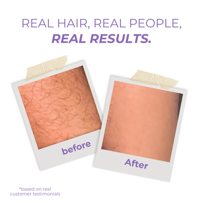 Glissy™ – Crystal Hair Eraser