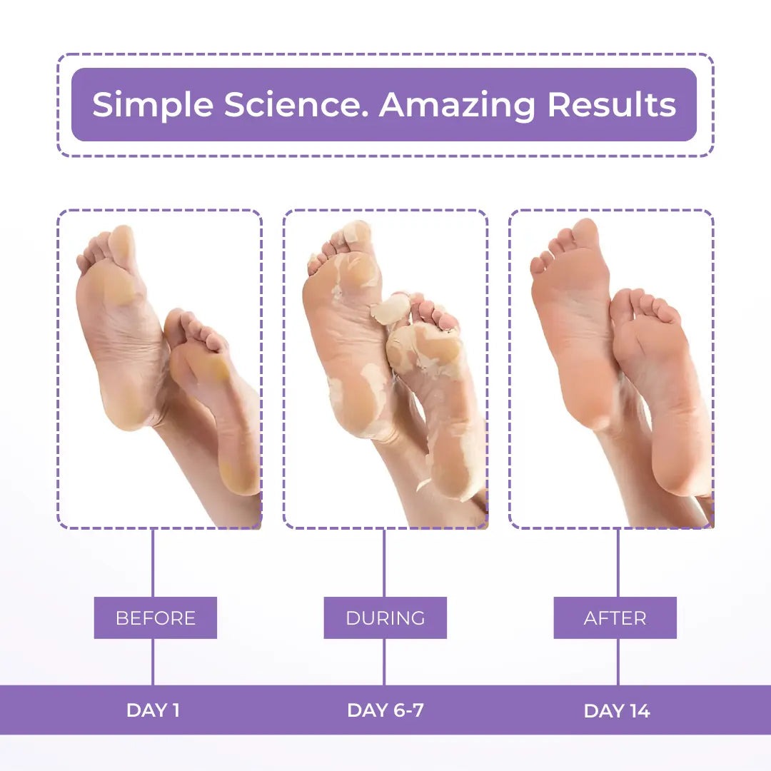 Lavender Foot Peeling Mask