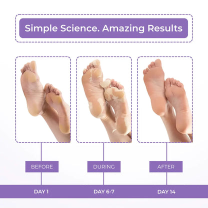 Lavender Foot Peeling Mask