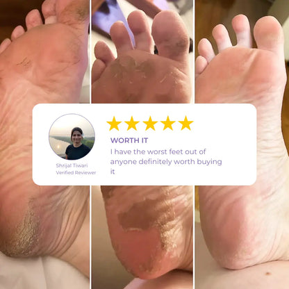 Lavender Foot Peeling Mask