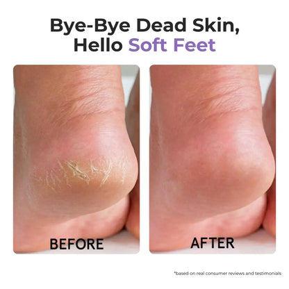 Lavender Foot Peeling Mask